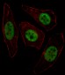 ULK2 Antibody (Center S323)